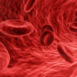 iron-deficiency-anemia-causes-diets-treatments-3