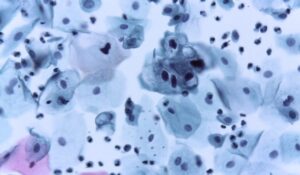 76ecd3930da9473db22db39ad4f99a1e